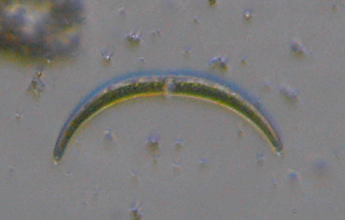Microscopia delle acque astatiche del Bosco di Foglino